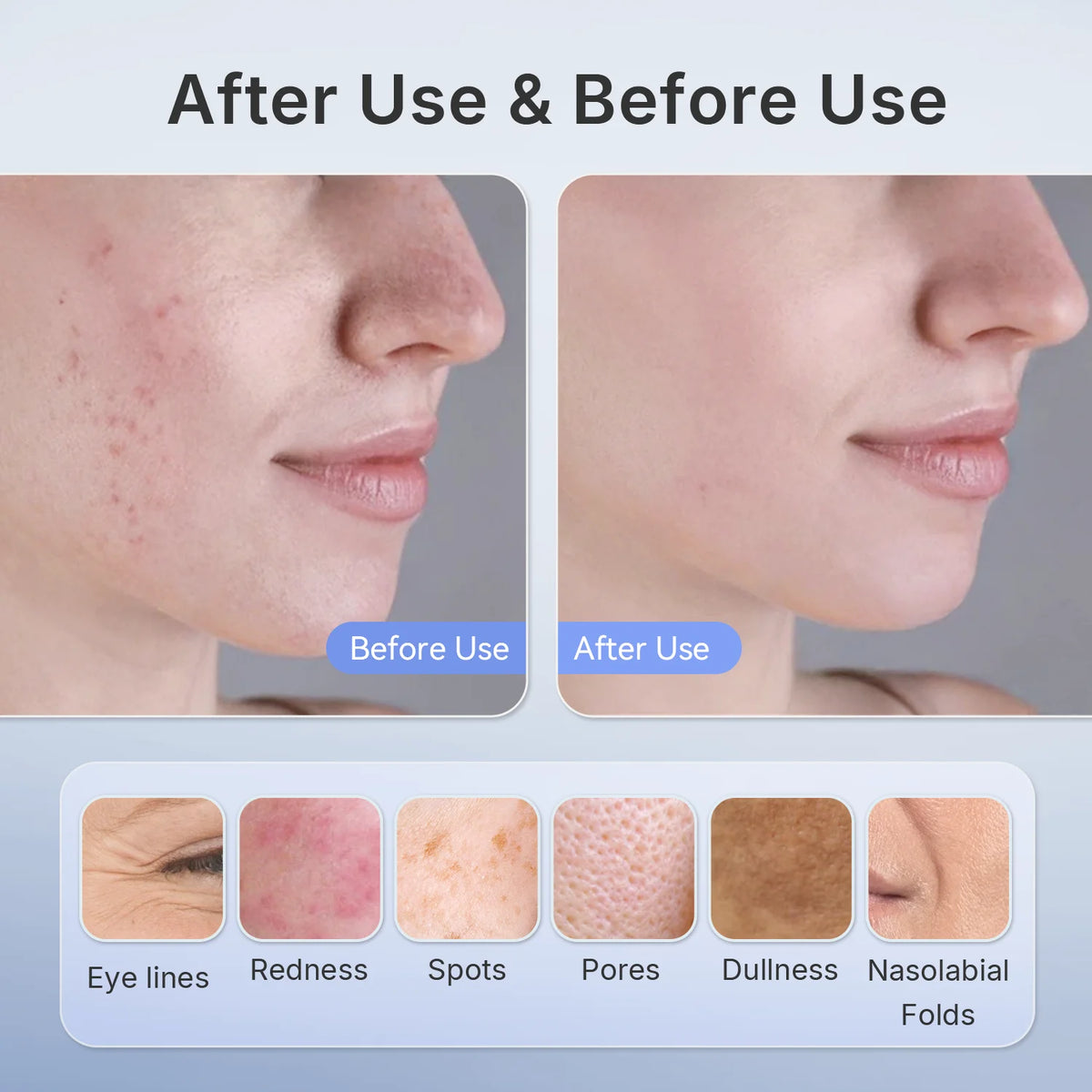 Vexaroa Wireless Red Light & Near-Infrared LED Facial Mask