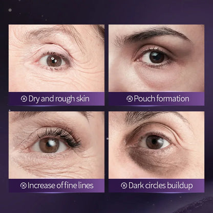 Vexaroa 60pcs Collagen Eye Mask Anti Dark Circles Anti-Aging