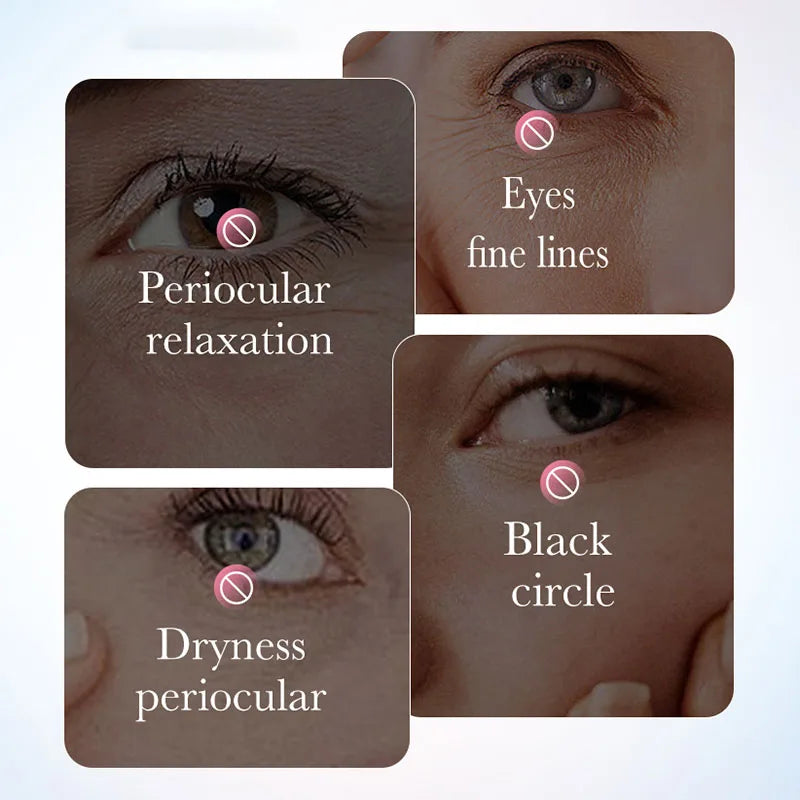 Vexaroa Sakura Eye Cream – Dark Circles & Anti-Aging Care
