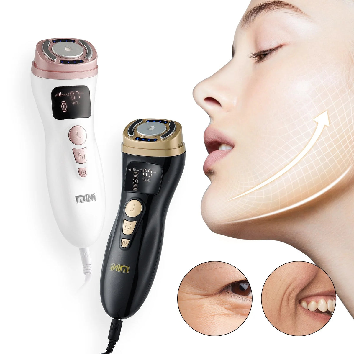Vexaroa Mini HIFU RF EMS Facial Lifting Skin Tightening Device — product image